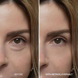 Dr.Melaxin Retinol Eyebag Cream