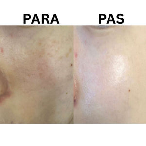 P.CALM Light Active Ampoule