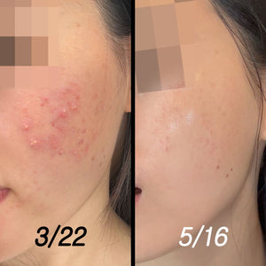 P.CALM Cicalacto Exosome 45 Sleeping Mask