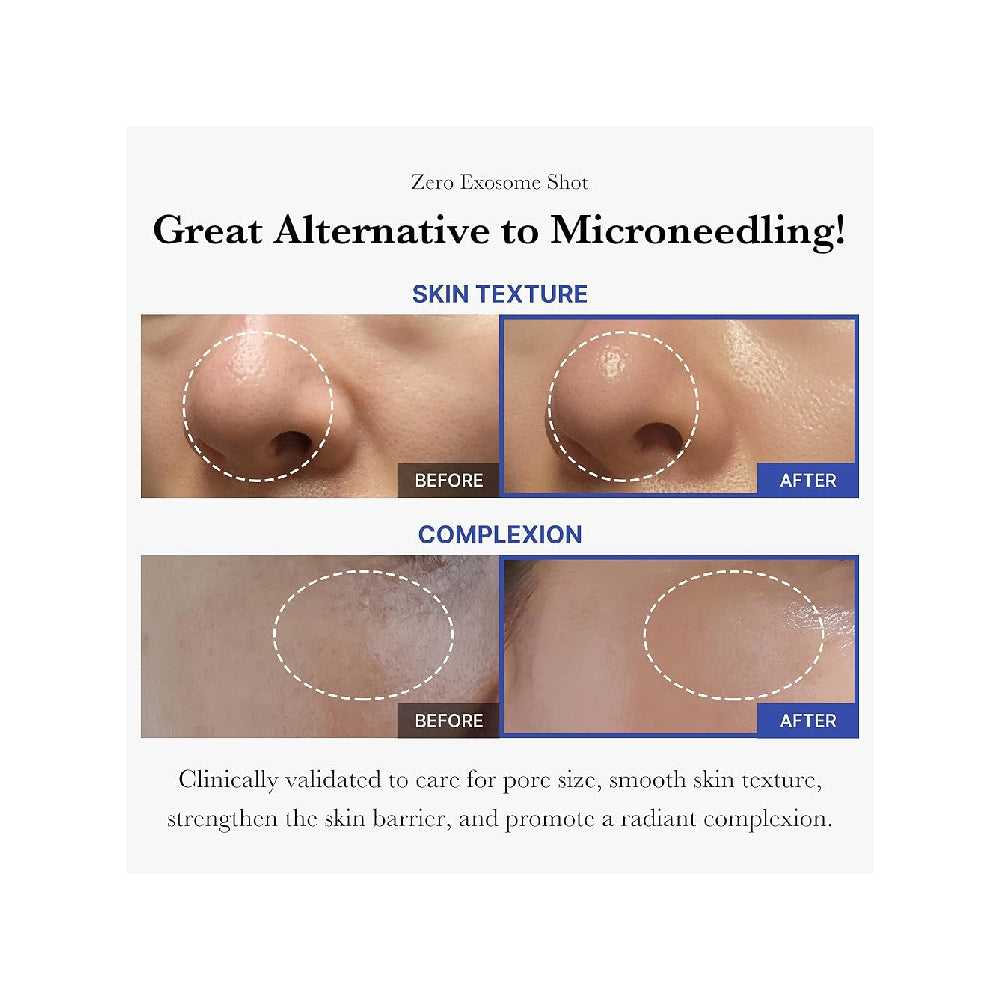 Medicube One Day Exosome Shot Pore Ampoule 7500
