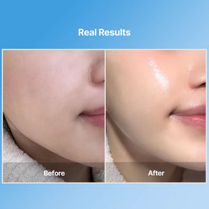 Meditherapy Blue layer Water Dome Collagen Mask