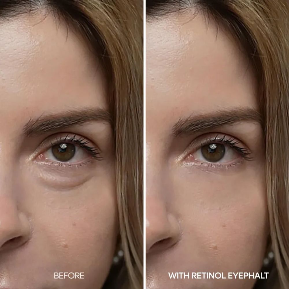 Dr.Melaxin Retinol Eyebag Cream