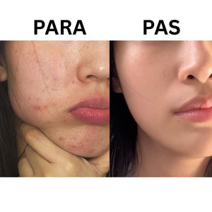 P.CALM Cicalacto Exosome 45 Sleeping Mask