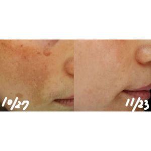 P.CALM Light Active Cream