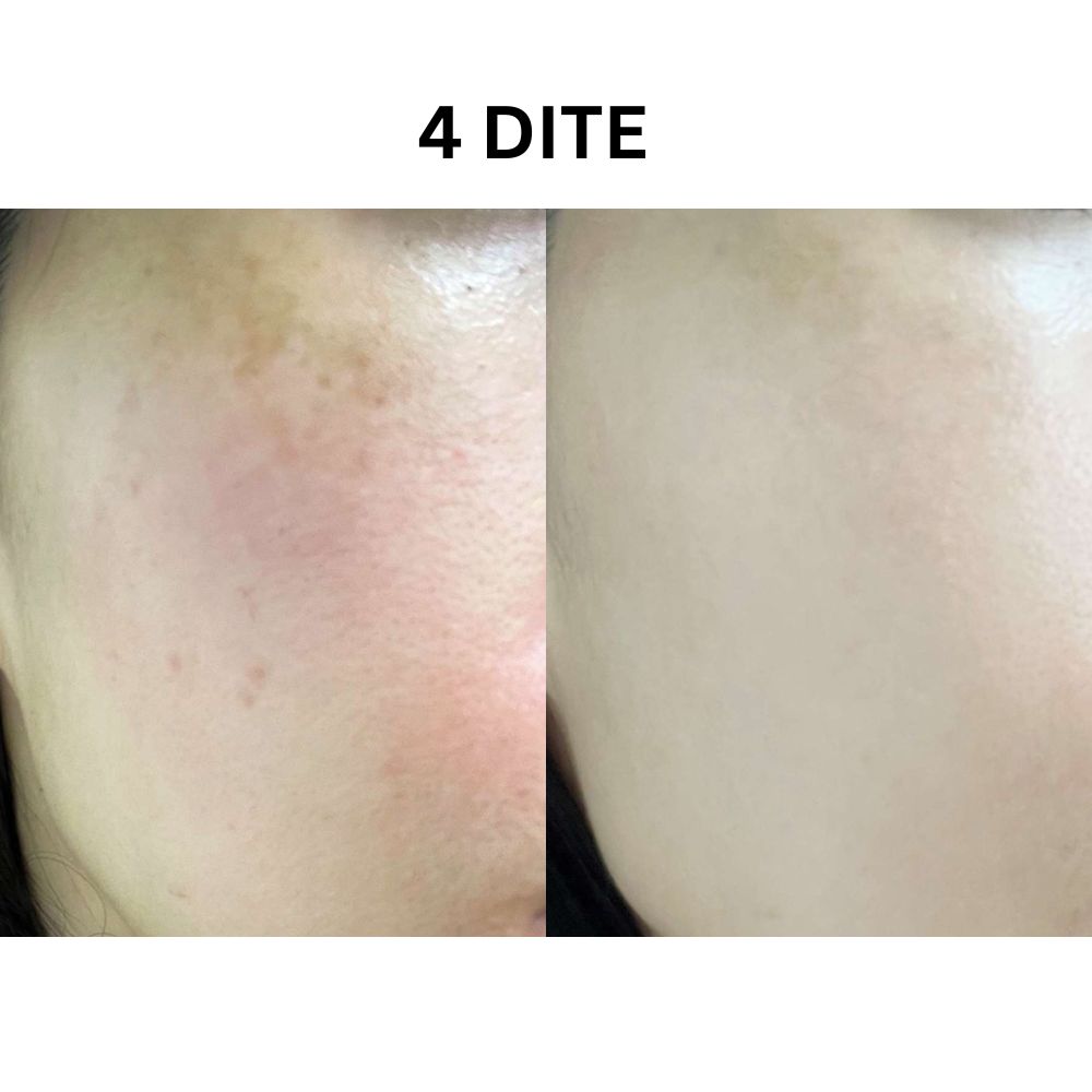 P.CALM Light Active Ampoule