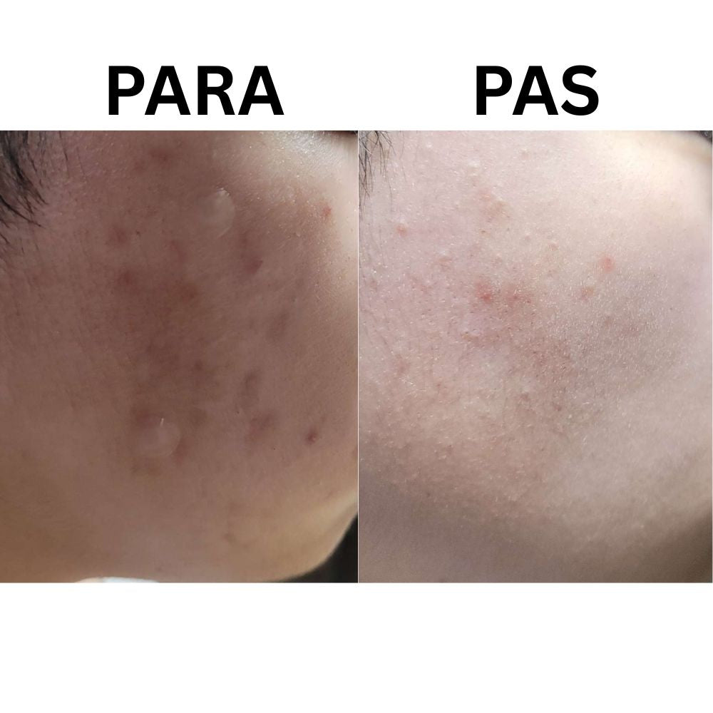 P.CALM Cicalacto Exosome 45 Sleeping Mask
