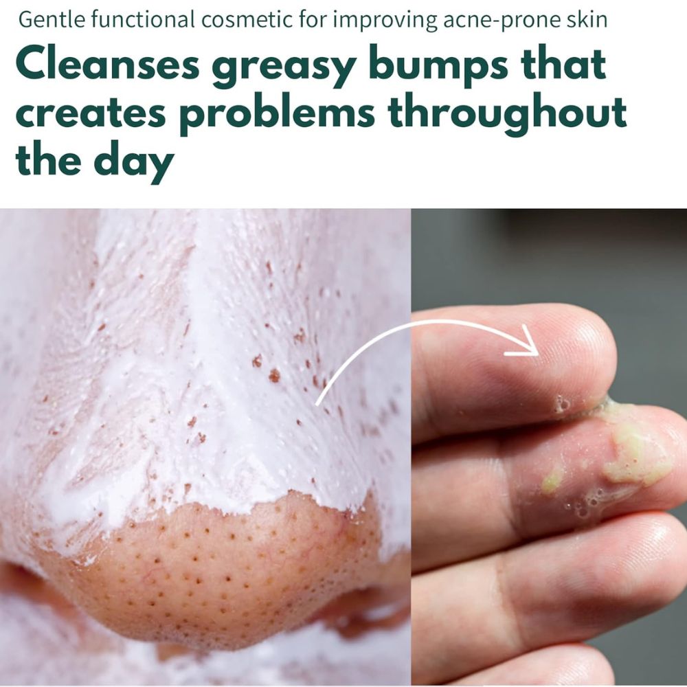 P.CALM UnderPore Foam Cleanser 150ml