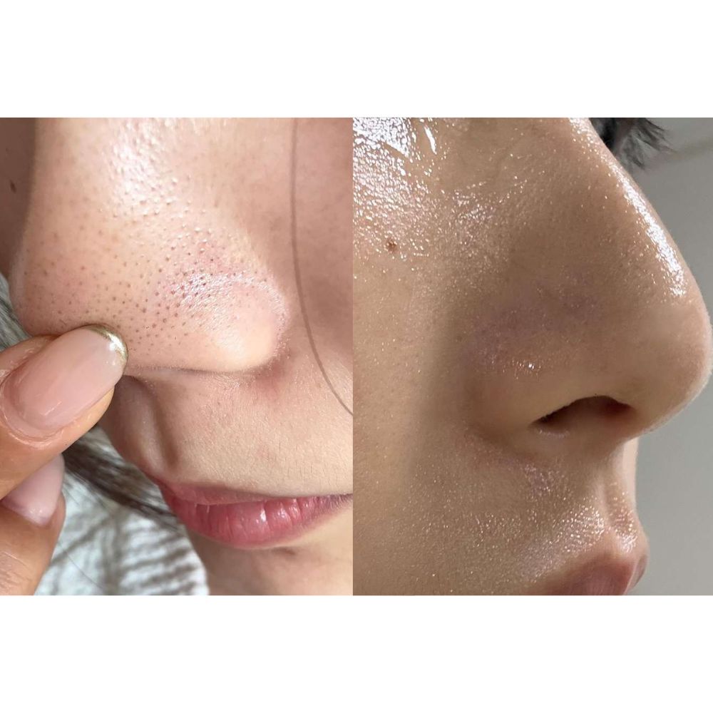 P.CALM Holy Basil Bubble Deep Mask