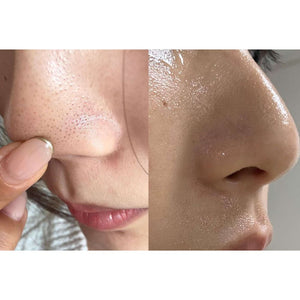 P.CALM Holy Basil Bubble Deep Mask