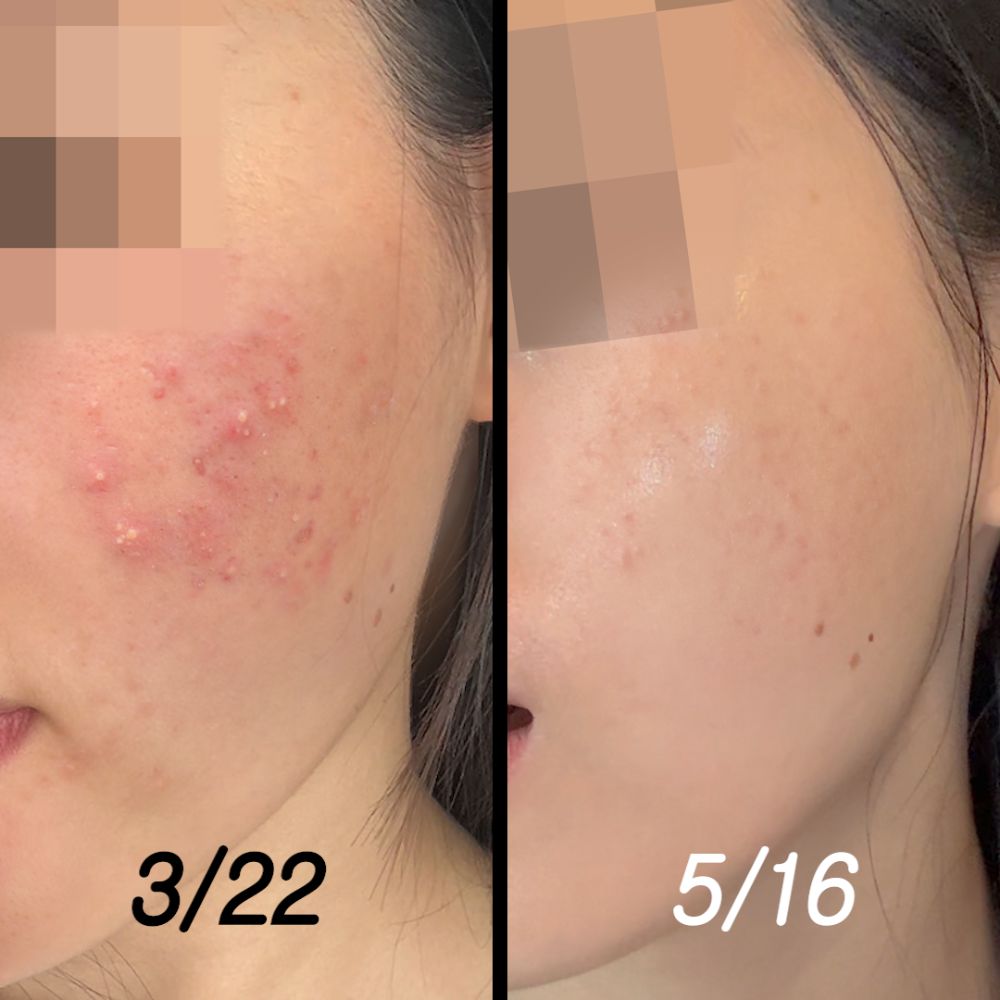 P.CALM Cicalacto Exosome 45 Sleeping Mask