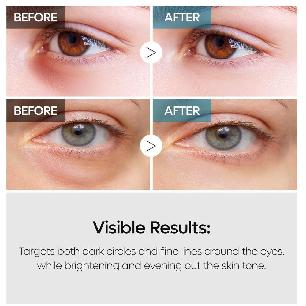 Dr.Melaxin TX Retinalsome Double Effect Eye Cream 40g