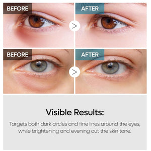 Dr.Melaxin TX Retinalsome Double Effect Eye Cream 40g