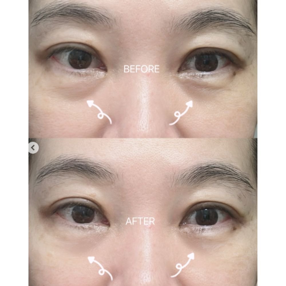 Dr.Melaxin Eyephalt Eyebag Cream 10ml
