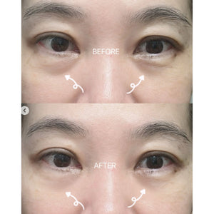Dr.Melaxin Eyephalt Eyebag Cream 10ml
