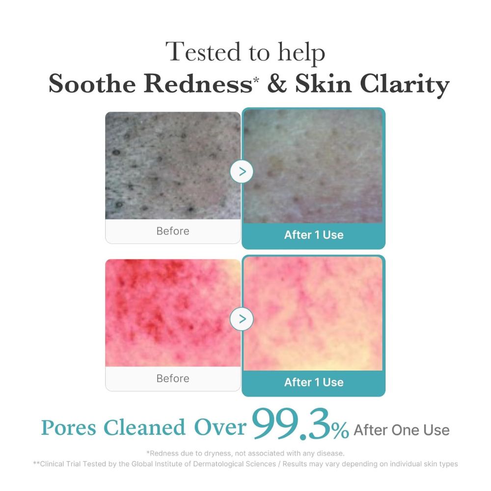 Medicube Azelaic Acid Niacinamide Deep Clean Foam Cleanser