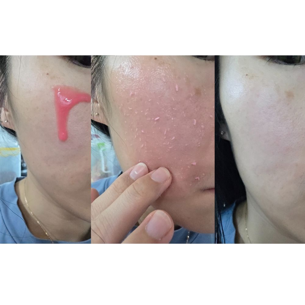 P.CALM Red Rice Glow Peel Shot 8 Serum 80ml