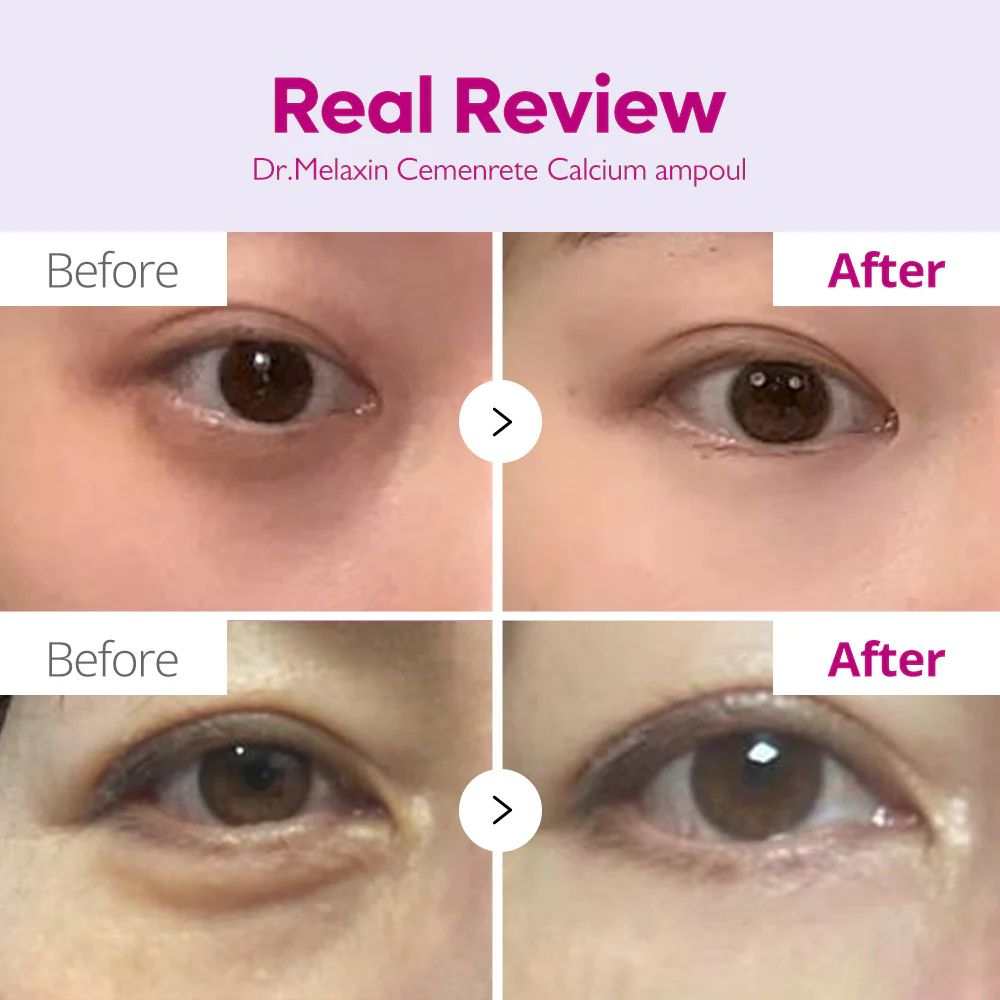 Dr.Melaxin Cemenrete Calcium Ampoule Plus
