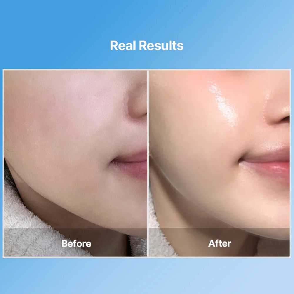Meditherapy Blue layer Water Dome Collagen Mask